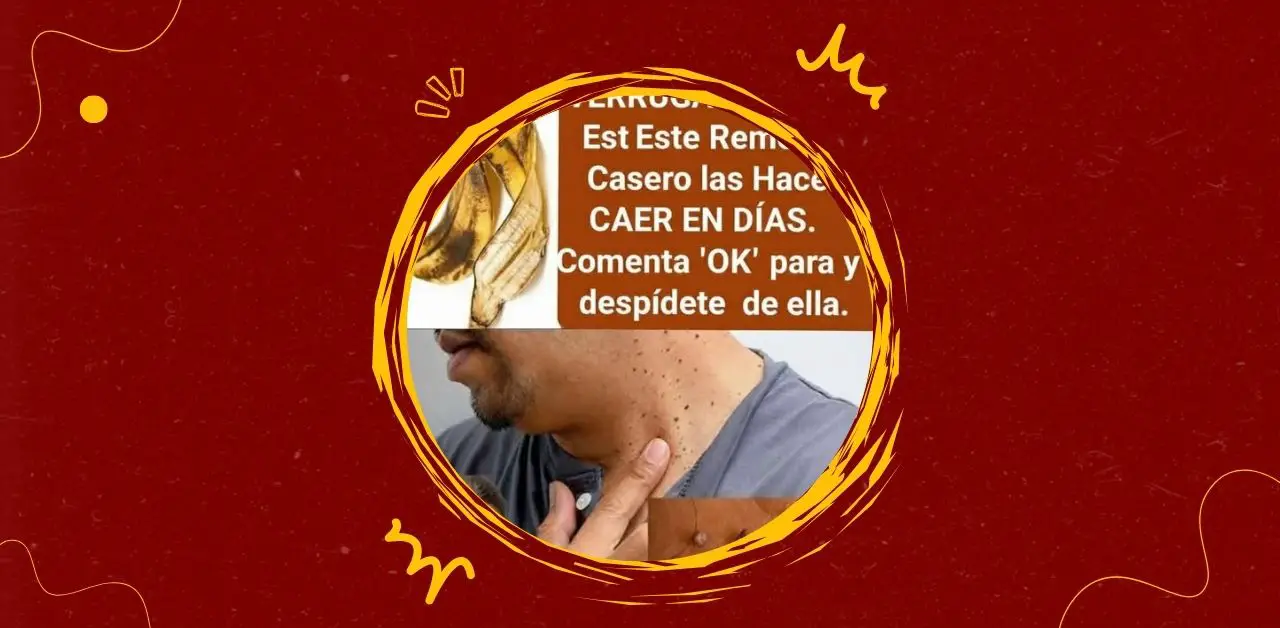 Banana Peel for Wart Removal Myth, Tradition, and Practical Considerations