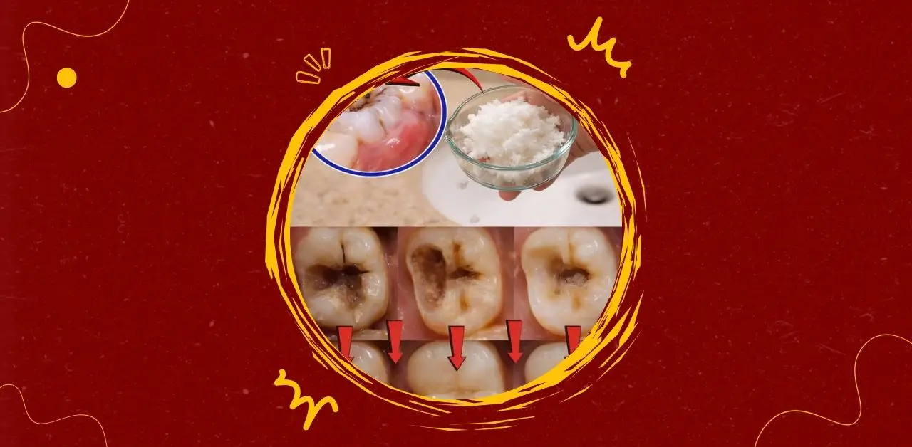Coconut and Dental Health Exploring Natural Approaches to Tooth Decay