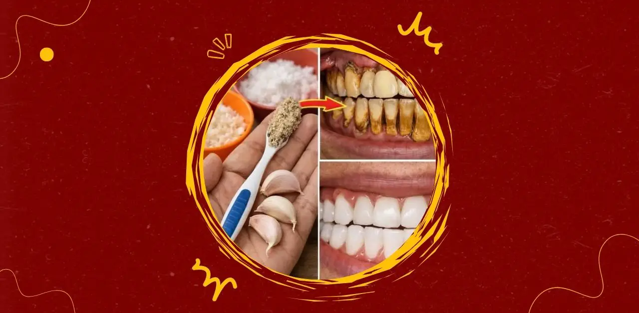 Natural Plaque Removal and Teeth Whitening Remedy