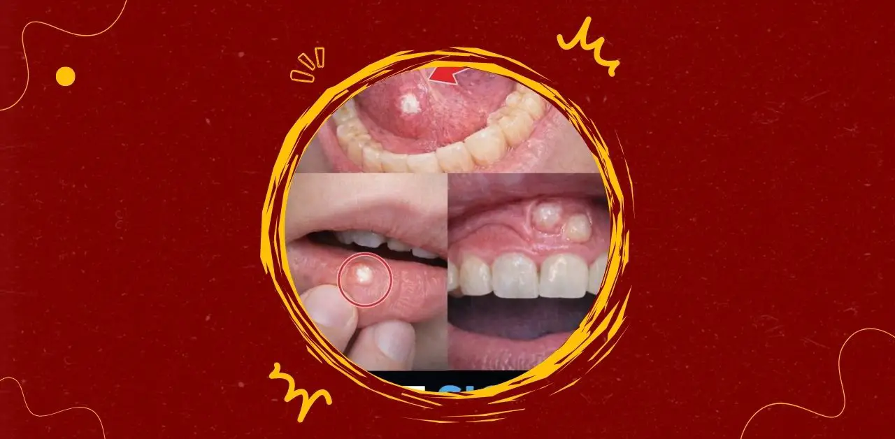 First Signs of Oral Health Conditions What You Should Know