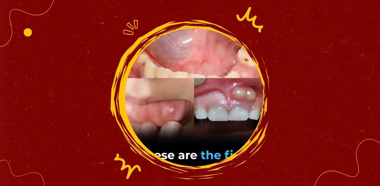 Early Symptoms of Oral Health Issues You Shouldn’t Ignore