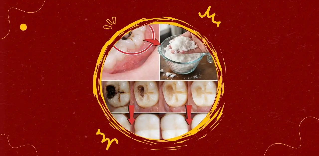 Natural Remedies and Tooth Decay