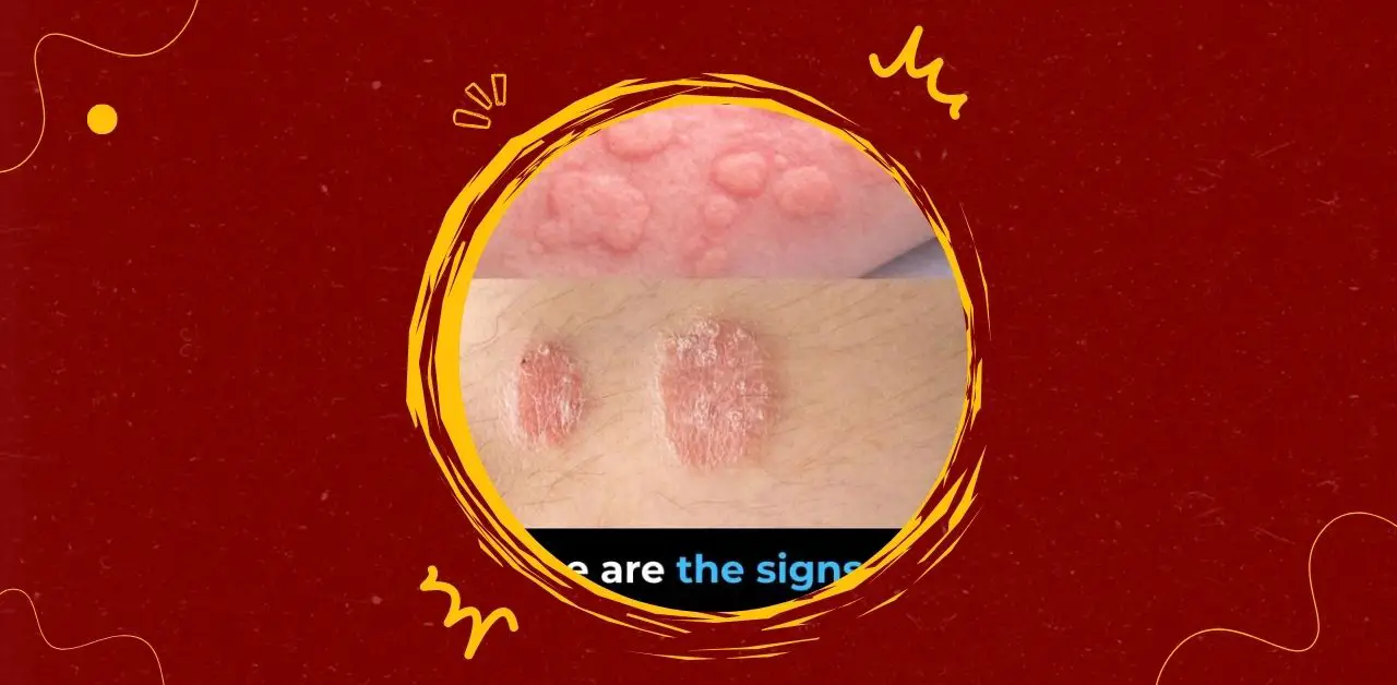Recognizing Common Skin Conditions