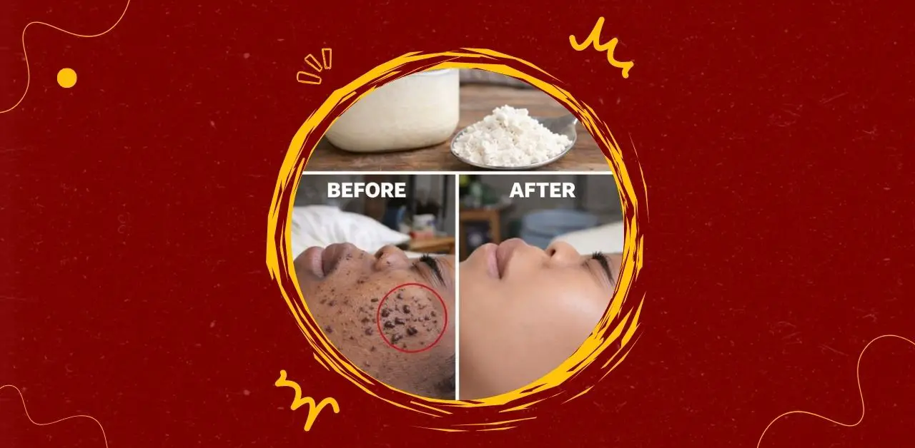 Rice Face Mask for Clear Skin Remedy