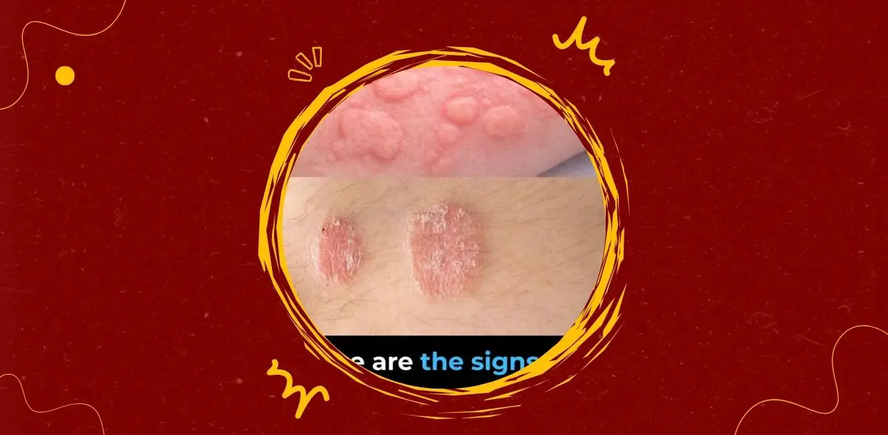 Common Skin Conditions and Their Signs You Need To Know