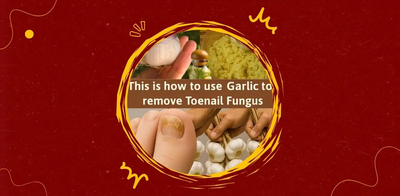 Natural Garlic Toenail Soothing Paste Recipe