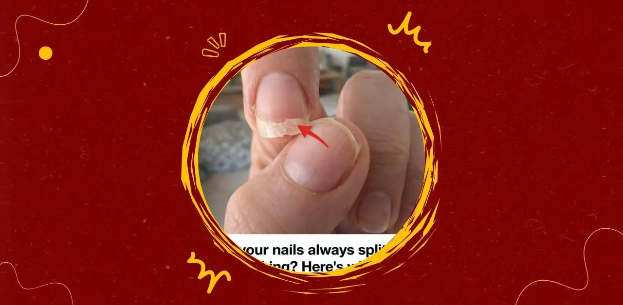 Why Nails Split or Break What Your Body May Be Signaling