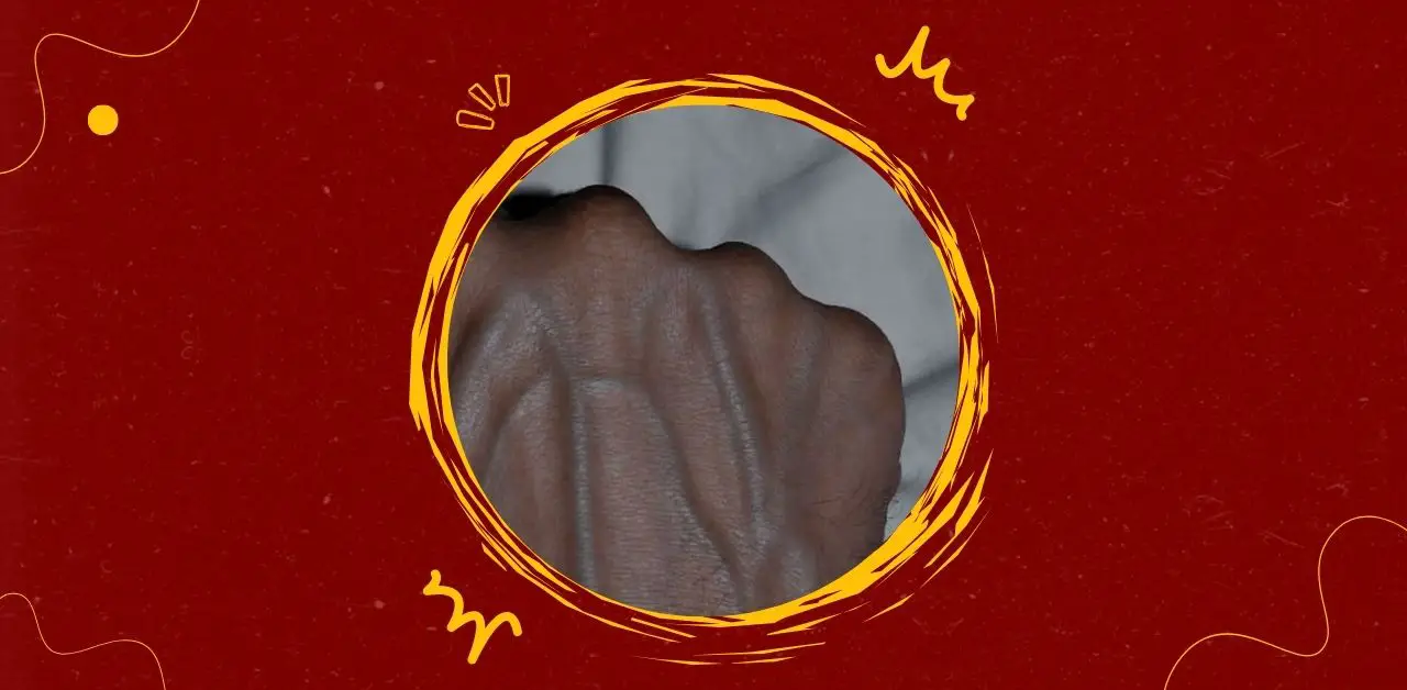Causes of Visible Veins in Hands You Need To Know