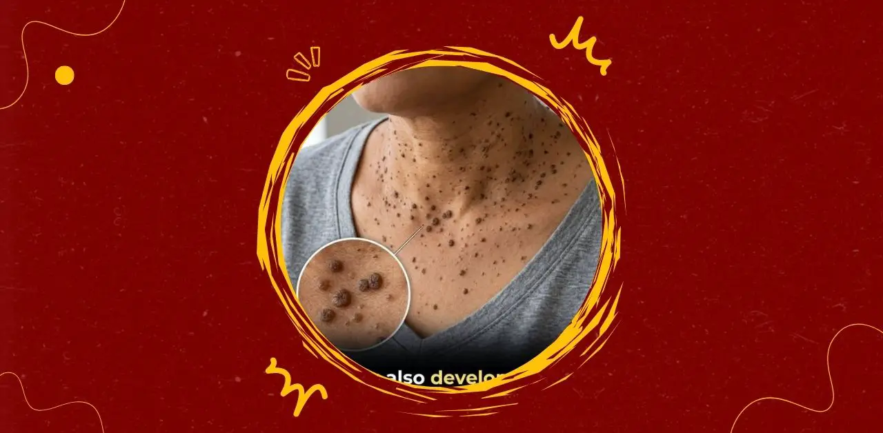 Understanding Skin Bumps on the Neck