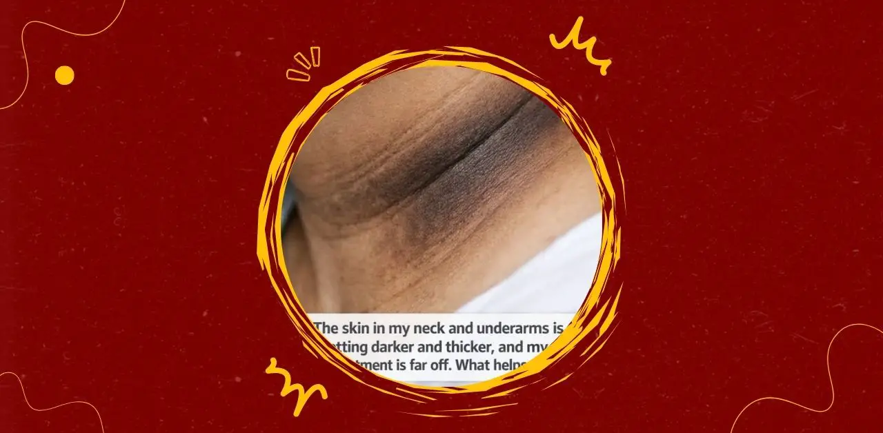 Darkened Skin on the Neck and Underarms What It Means and How to Care for It
