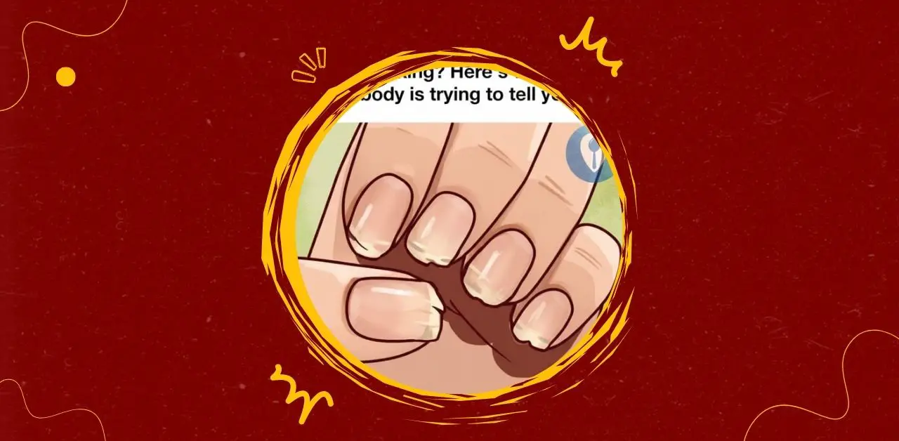 Understanding Nail Splitting and Breaking You Need To Know