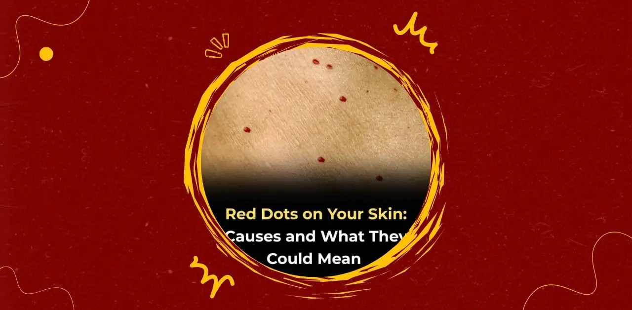 Red Dots On Yours Skin Causes and What They Could Mean