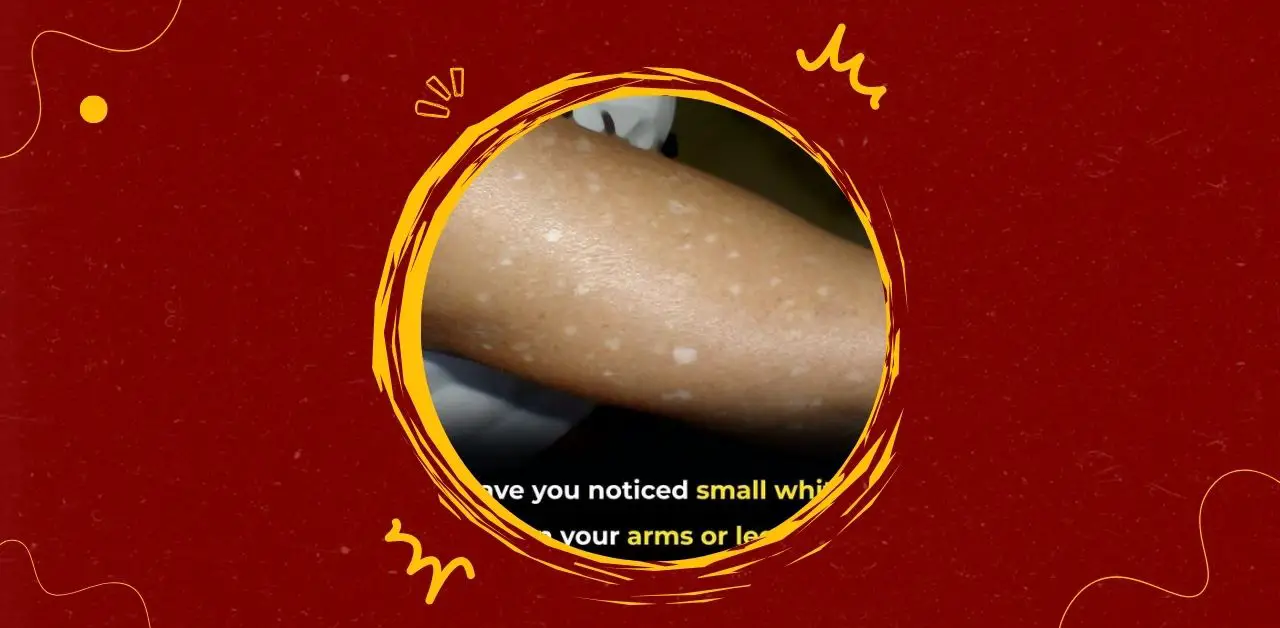 Small White Spots on Arms or Legs What They Mean