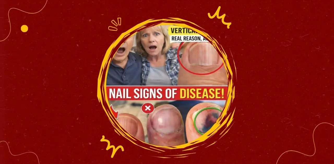 Nail Health What Changes in Your Fingernails Could Mean