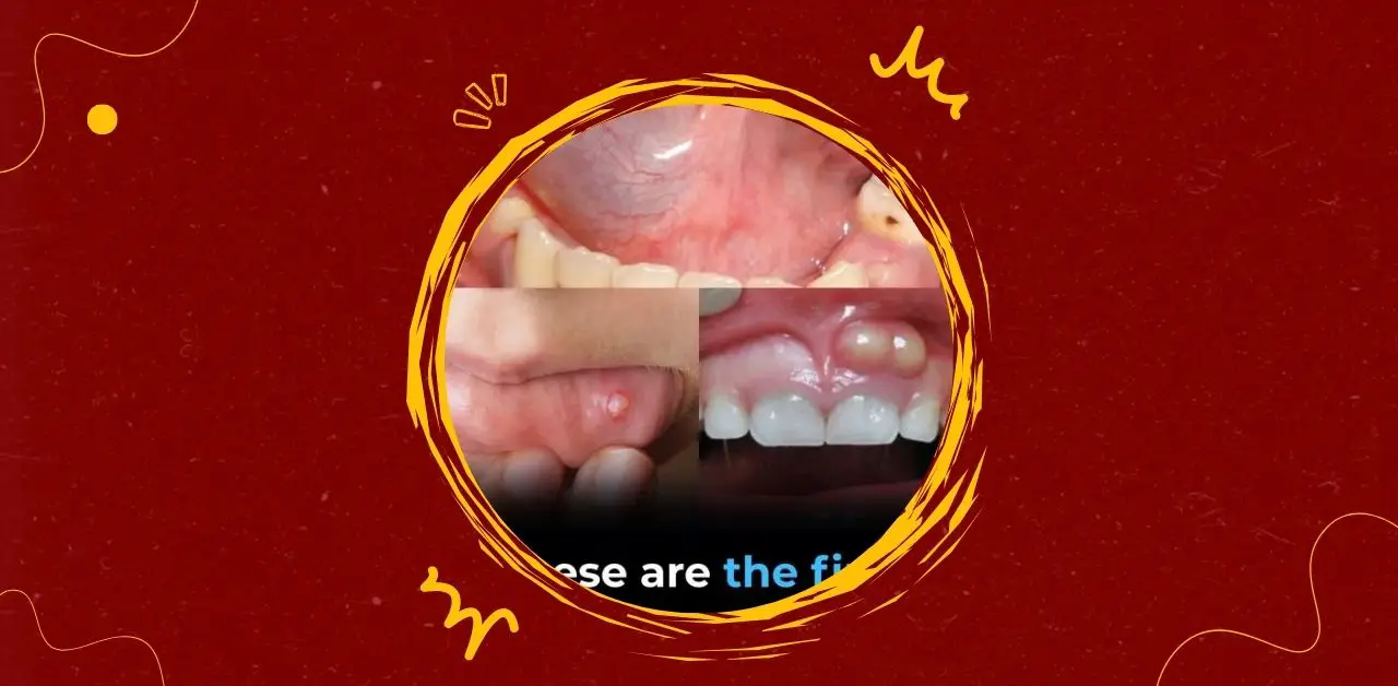 Recognizing Early Signs of Oral Health Issues