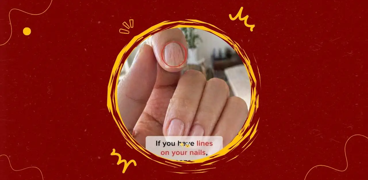 Nail Health and Vertical Lines What They Reveal