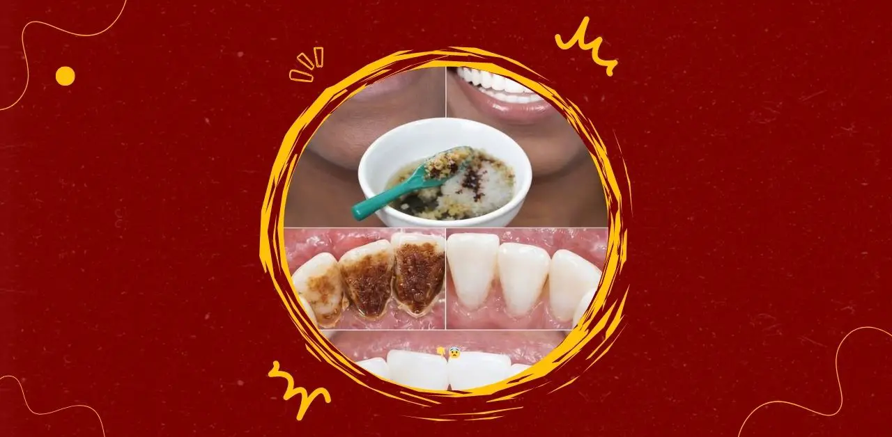 Natural Teeth Whitening Paste Recipe