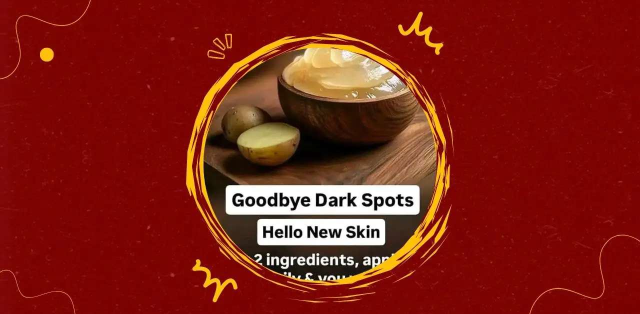 Natural Potato Aloe Vera Skin Gel Remedy