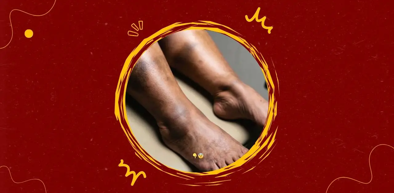 The Consequences of Sleeping with Poor Leg Positioning or Circulation Issues