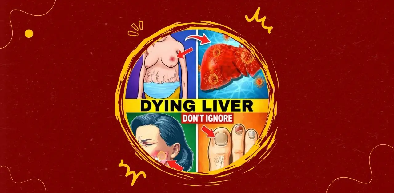 Steatotic Liver (Fatty Liver) and Its Signs You Need To Know