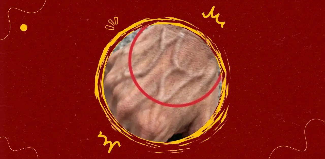 Prominent Veins in the Hands You Need To Know