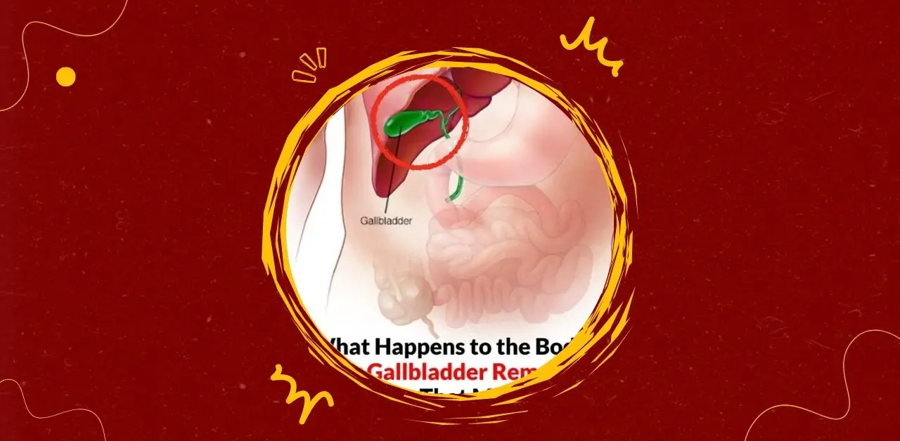 What Happens to the Body After Gallbladder Removal