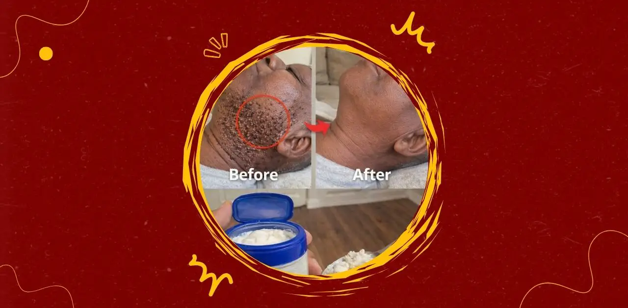 Natural Skin-Soothing Cream Remedy