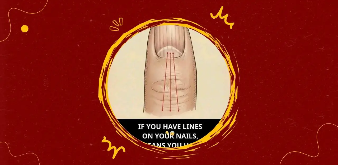 Understanding Vertical Lines on Fingernails