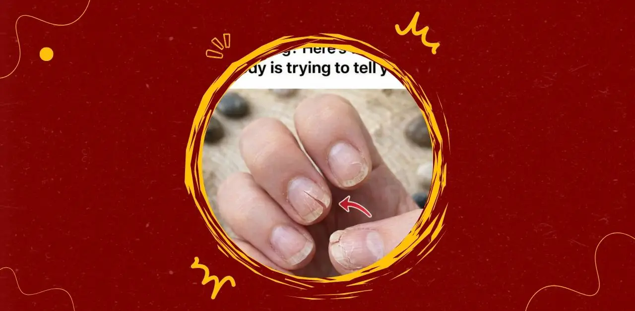 Why Your Nails Split What Your Body Is Telling You