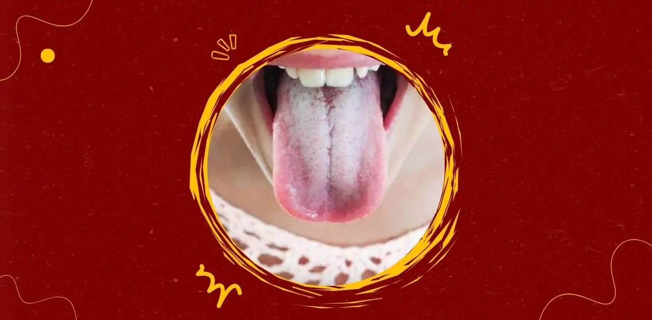 Tongue Coating What It Reveals About Your Health