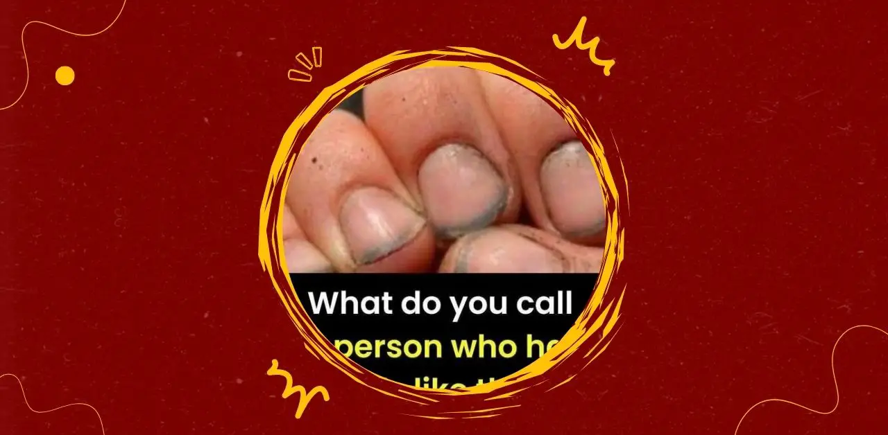 The Story Behind Dirty Fingernails More Than Meets the Eye